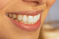 Six Month Smiles | Dentist in Trenton, MI | Booker Family Dentistry